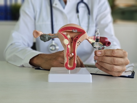 Ovulation Induction Treatment: Boost Fertility with Irregular Cycles | Fyh.news