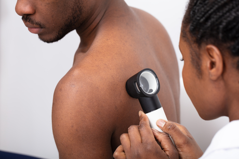 Underdiagnosis of Skin Conditions in People of Color