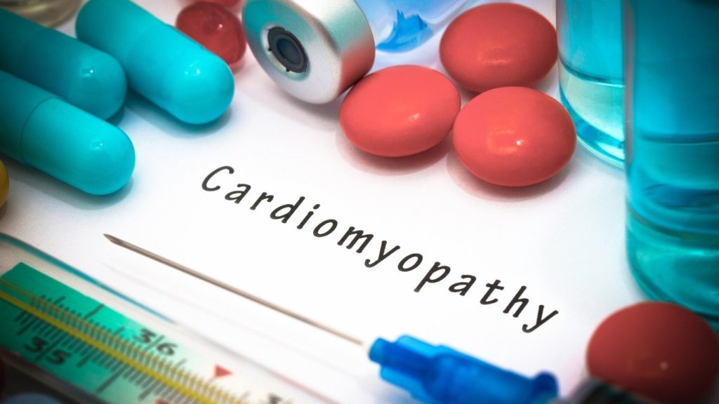 Transthyretin amyloid cardiomyopathy and ATTR-CM | Fyh.news