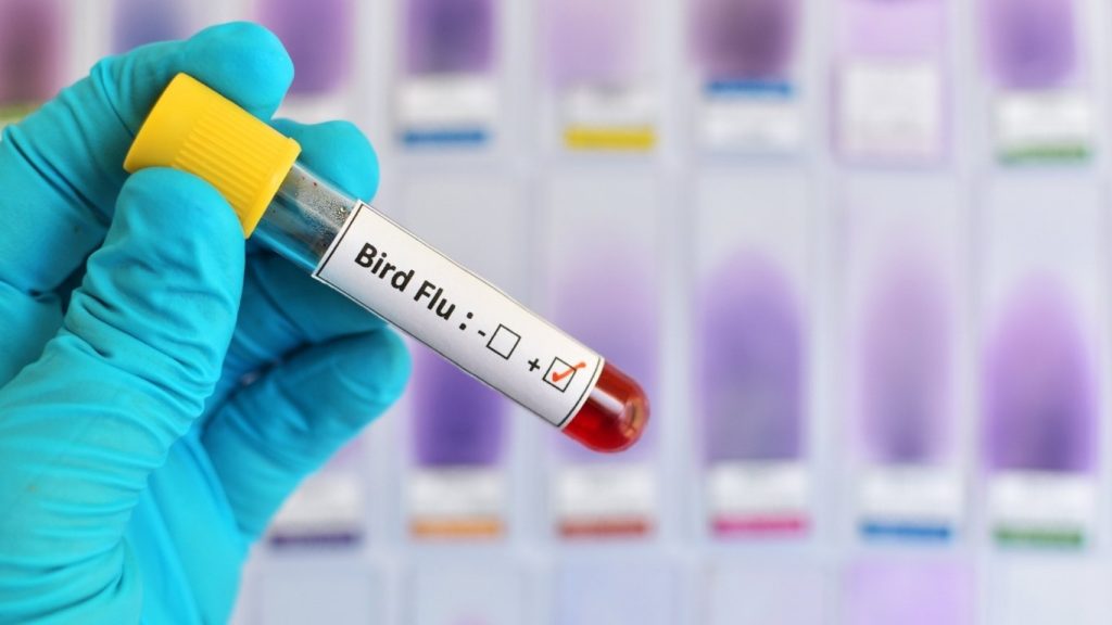 Bird Flu Milk Safety Is Milk Safe in 2026 Fyh.news